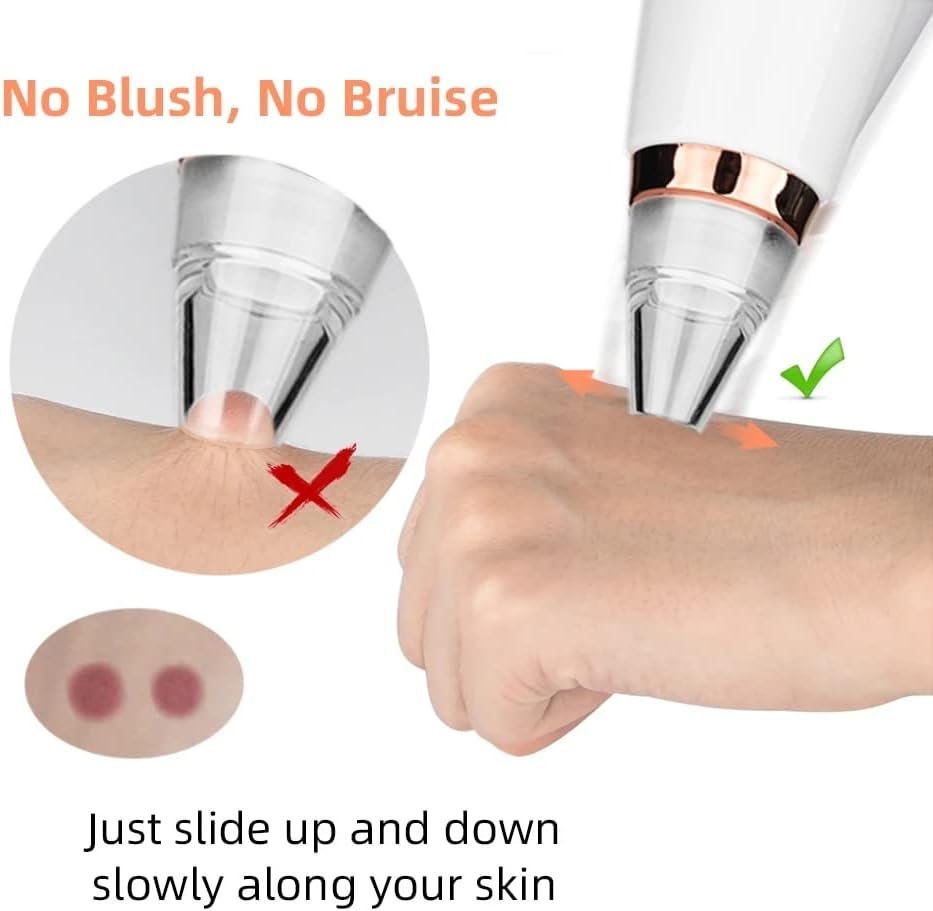 Rechargeable Blackhead Vacuum