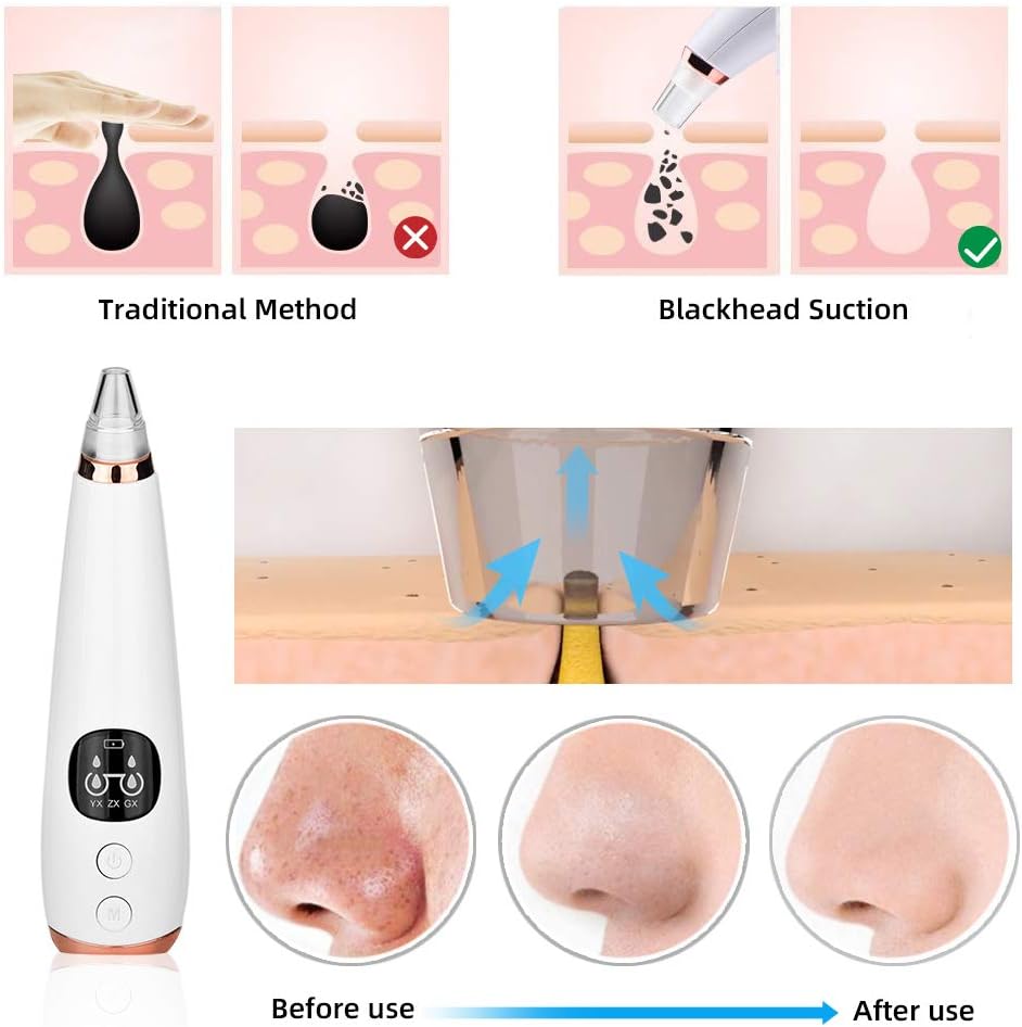 Rechargeable Blackhead Vacuum