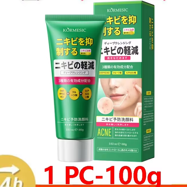 Salicylic Acid Acne Face Cream