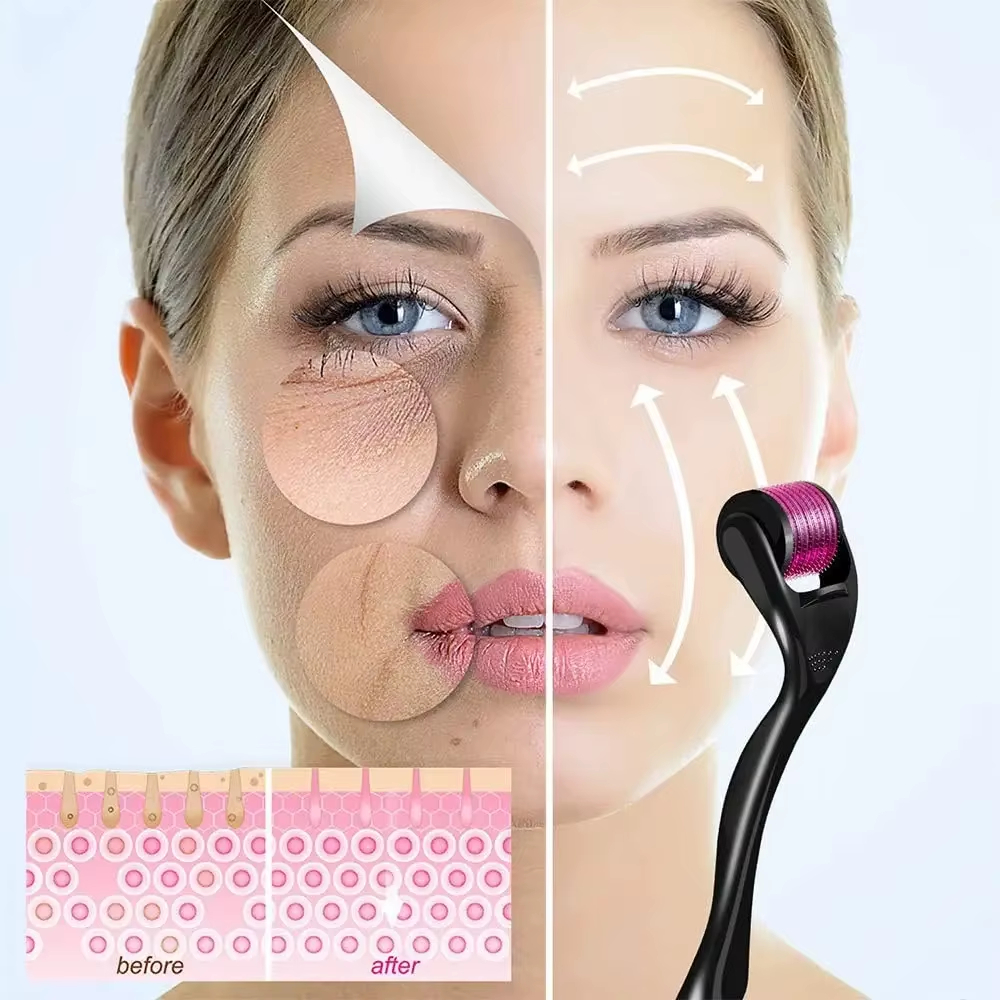 540 Derma Roller