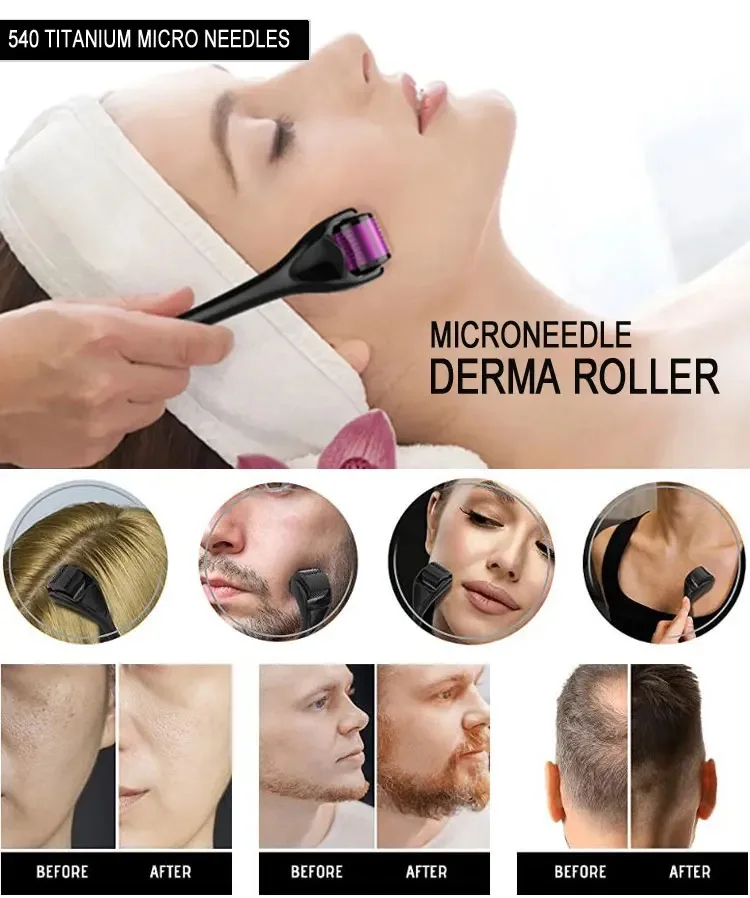 540 Derma Roller