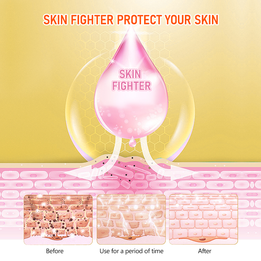 كريم Skin Fighter المرمم 15 غ