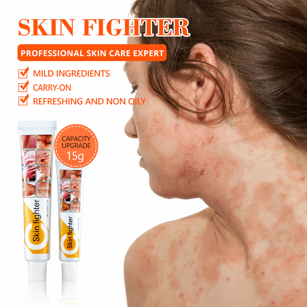 كريم Skin Fighter المرمم 15 غ