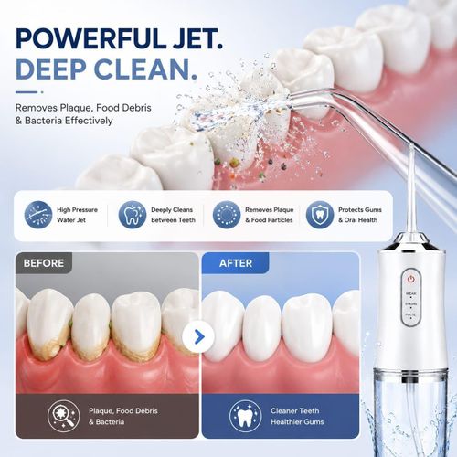 Portable Water Flosser
