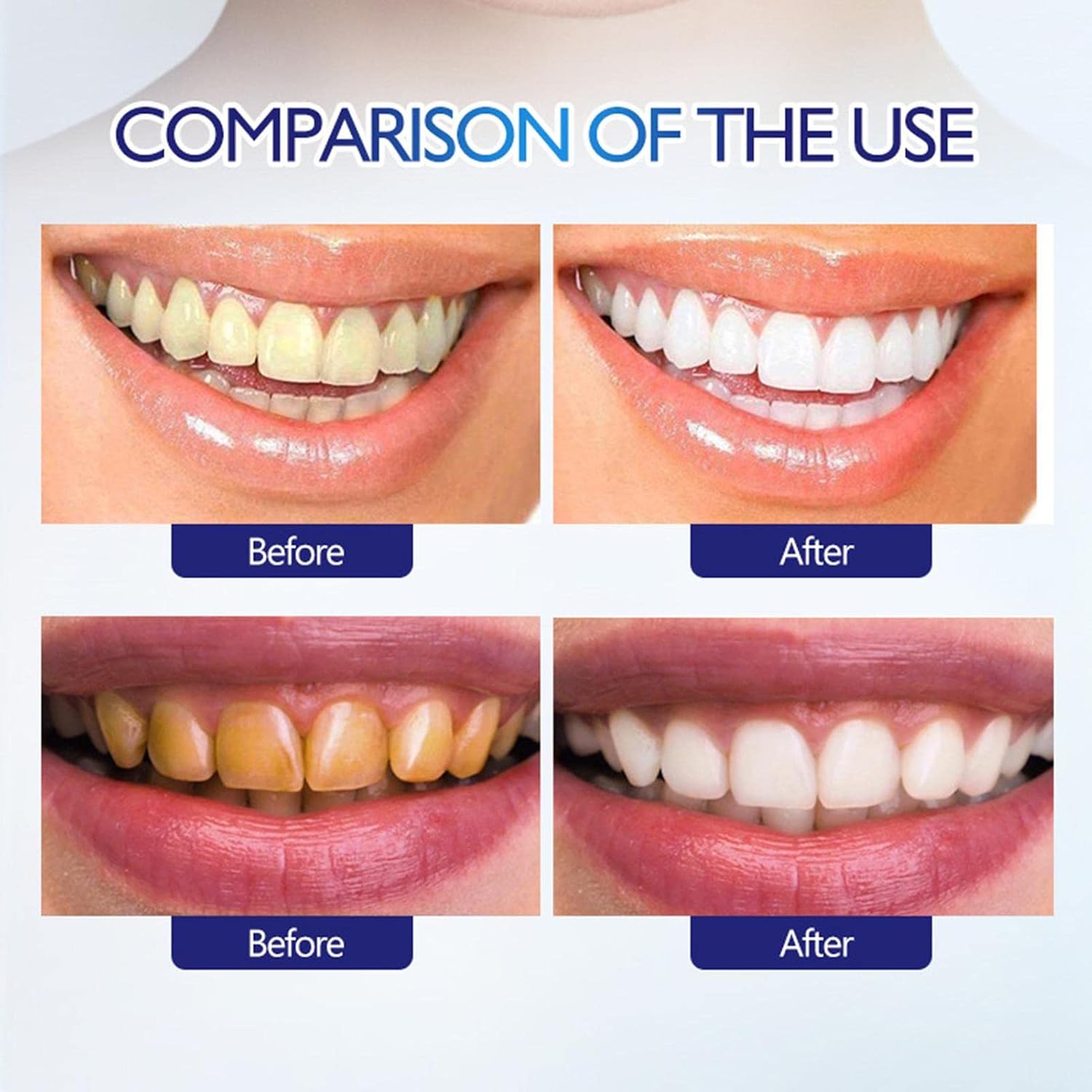 Hyaluronic Acid Whitening Toothpaste
